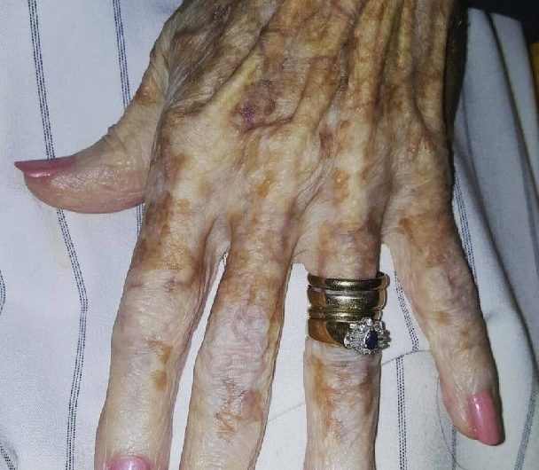 Eine Krankenschwester machte ein Foto von einer älteren Frau, das schnell viral ging. Die Geschichte berührte viele Menschen und verbreitete eine starke Botschaft über Lebenserfahrung und Selbstakzeptanz.