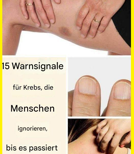 15 Krebs-Warnzeichen, die viele ignorieren – bis es zu spät ist