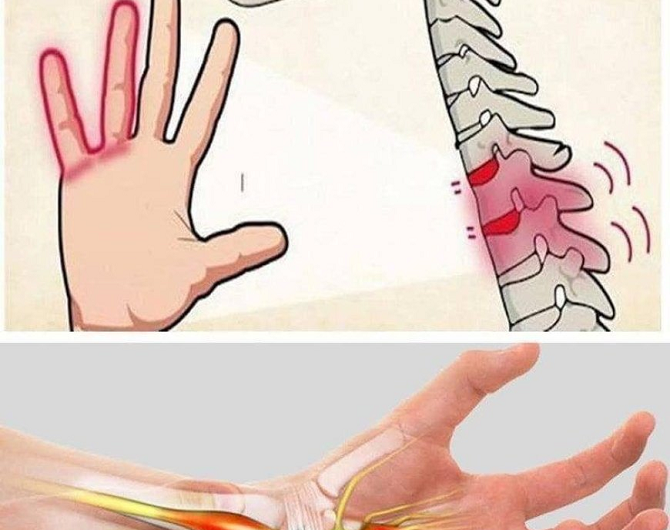 Taube Hände: Harmloses Symptom oder ernstes Warnsignal? Alles, was Sie wissen müssen