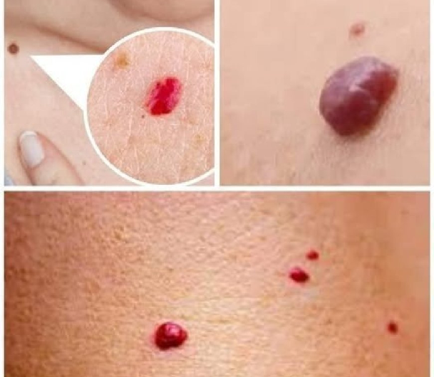 Rote Punkte auf der Haut? Das können die möglichen Ursachen sein!