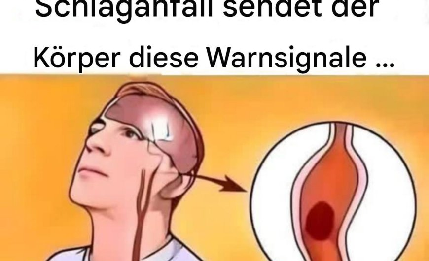 Schlaganfall Symptome: Die leisen Warnsignale, die dein Leben retten können