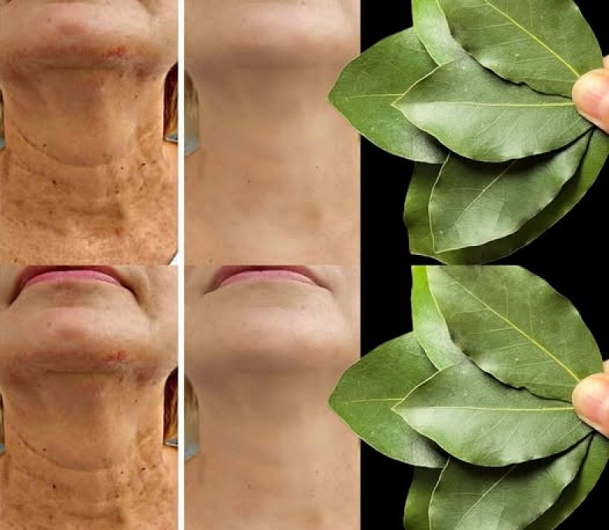 100.000 Mal wirksamer als Botox? Was ein einfaches Lorbeerblatt mit meiner Haut gemacht hat…