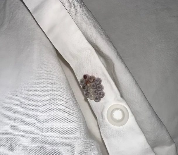 „Diese kleinen Kugeln lagen plötzlich in meinem Bett – und ich hatte keine Ahnung, was es war…