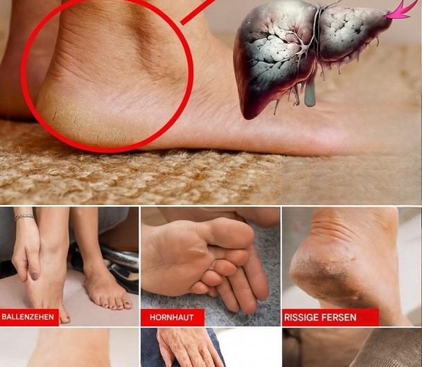 Deine Füße schreien nach Aufmerksamkeit – was sie dir wirklich über deine Gesundheit verraten