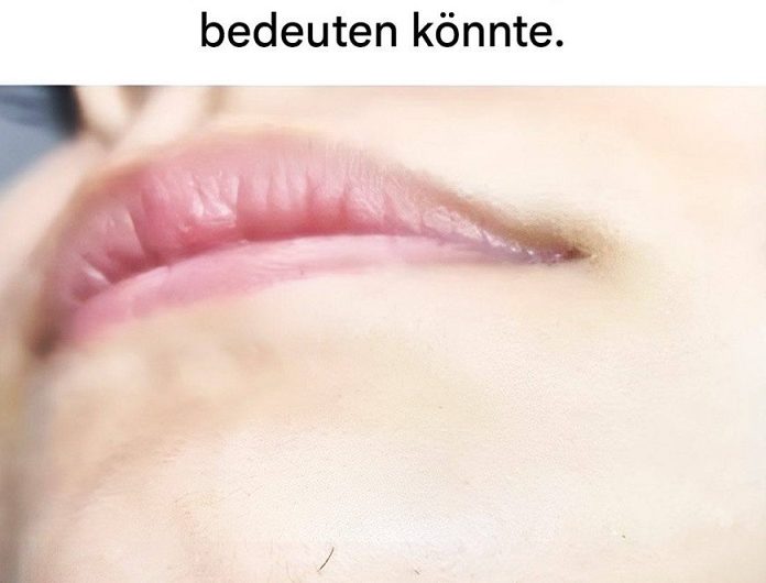 Kinnhaare bei Frauen: Was sie wirklich bedeuten – und warum du dir keine Sorgen machen musst