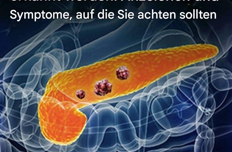 Bauchspeicheldrüsenkrebs erkennen, bevor es zu spät ist: Symptome, Frühwarnzeichen und was Sie beachten sollten
