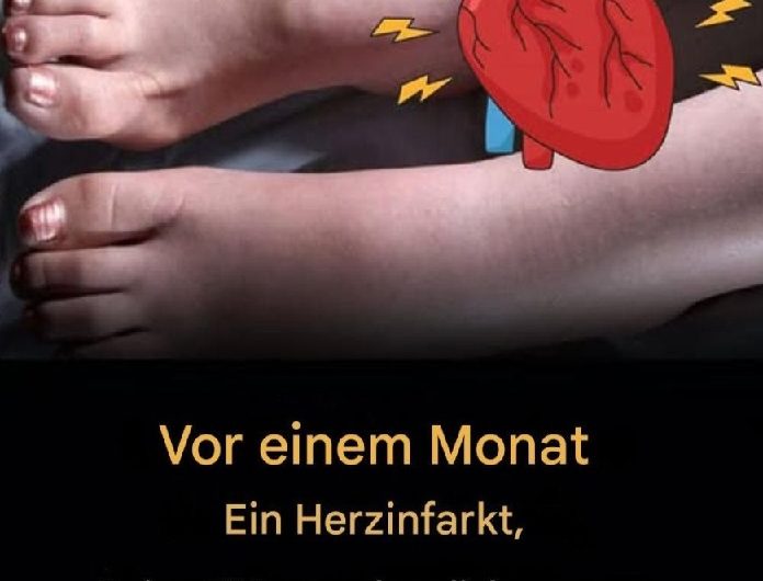 Einen Monat vor einem Herzinfarkt warnen Sie Ihre Füße vor diesen 6 Anzeichen