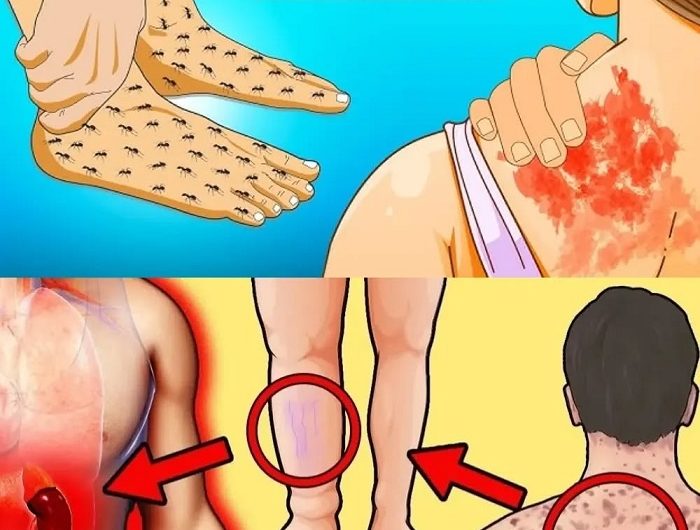 Wenn die Nieren flüstern – und niemand hinhört: 23 unscheinbare Warnzeichen, dass Ihre Nieren dringend Hilfe brauchen