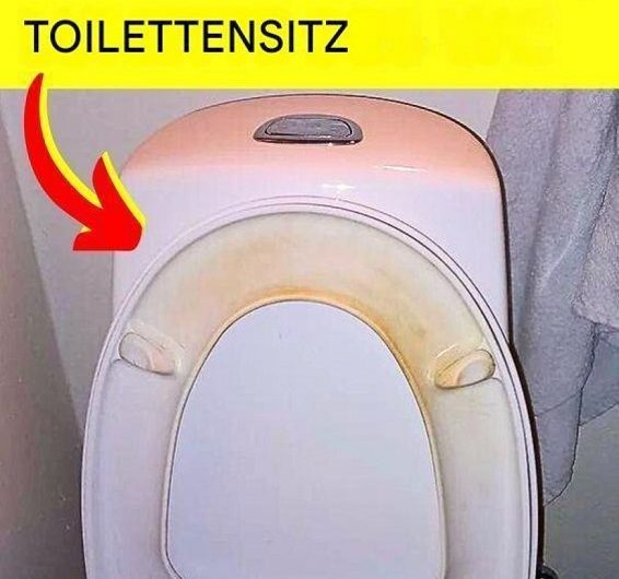 Der Trick, um gelbe Flecken auf dem WC-Sitz zu entfernen – und was meine Oma mir beigebracht hat