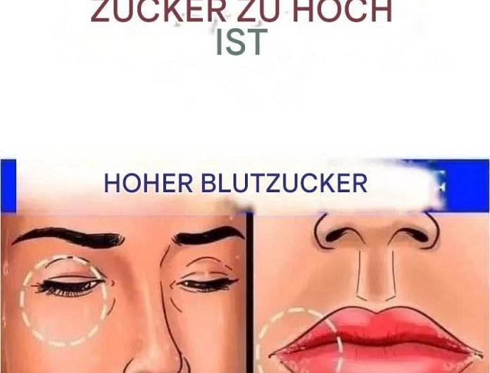 12 Anzeichen dafür, dass Ihr Zuckerhaushalt im Körper aus dem Gleichgewicht sein könnte