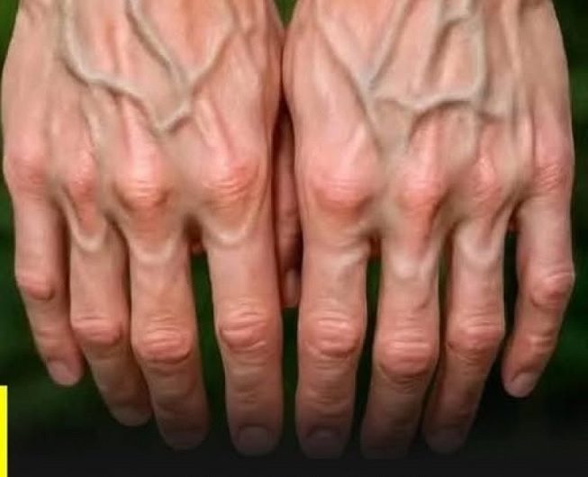 Warum treten die Venen an den Händen bei manchen Menschen so stark hervor? Das steckt häufig dahinter
