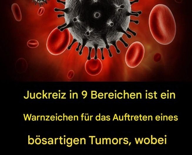 Wenn Juckreiz mehr bedeutet: 9 Körperbereiche und wann man genauer hinschauen sollte