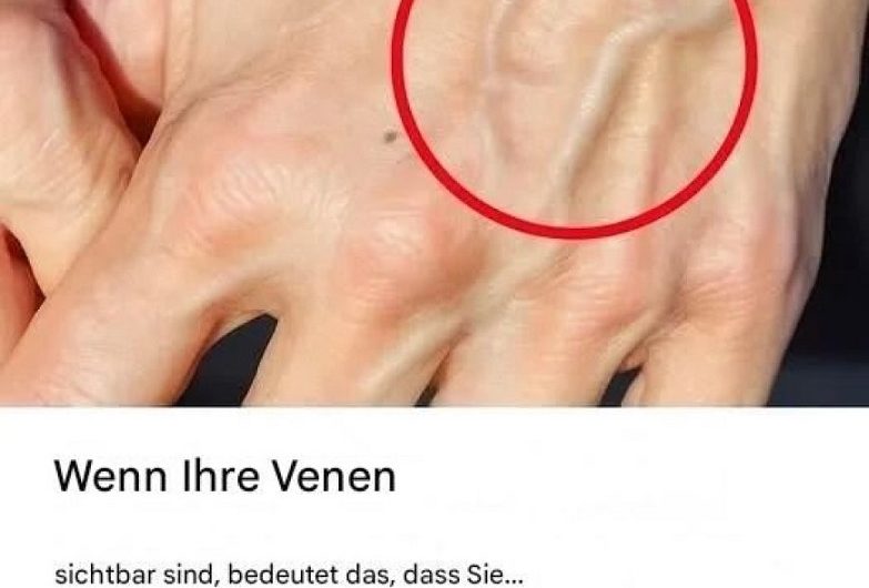 Wenn Ihre Venen sichtbar sind – was dahinterstecken kann und wann man genauer hinschauen sollte