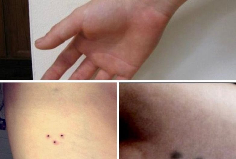 Drei Punkte als Tattoo: Was dieses kleine Zeichen wirklich bedeuten kann