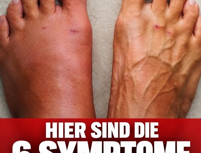 Hier sind die 6 Symptome, die Sie ernst nehmen sollten