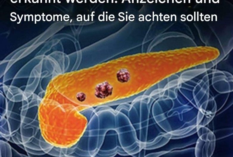 10 Anzeichen von Bauchspeicheldrüsenkrebs, die Sie nicht ignorieren sollten