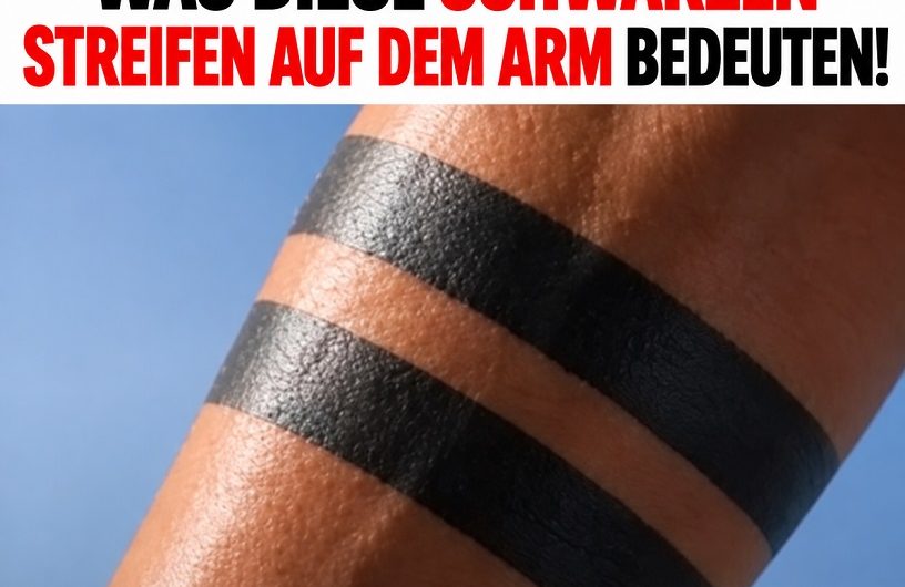 Black-Band-Tattoos: Was die schwarzen Streifen am Arm wirklich bedeuten können