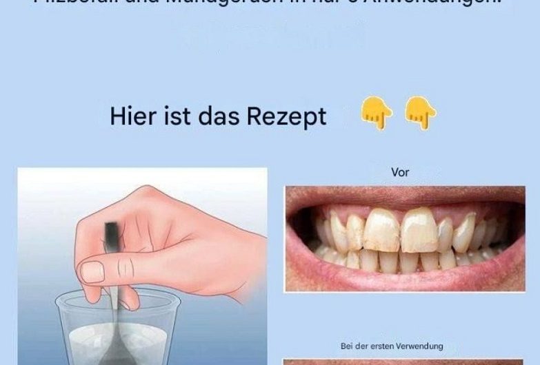 Zahnstein entfernen und gelbe Zähne aufhellen: Was wirklich hilft – und welcher Hausmittel-Trick mehr schadet als nützt