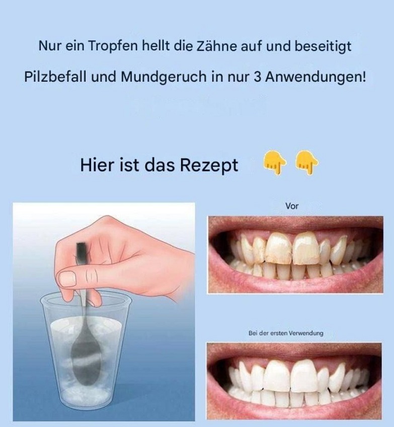 Zahnstein entfernen und gelbe Zähne aufhellen: Was wirklich hilft – und welcher Hausmittel-Trick mehr schadet als nützt